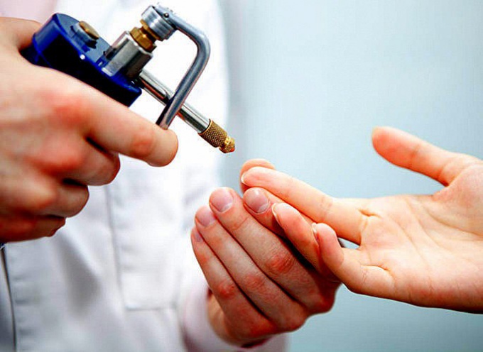 crioterapia thiene schio vicenza