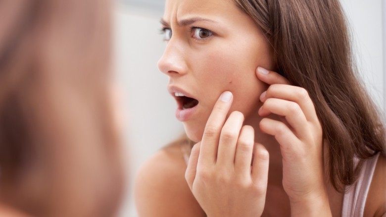 Basta nascondersi! Curiamo l’acne con Kleresca® e la Terapia Biofotonica