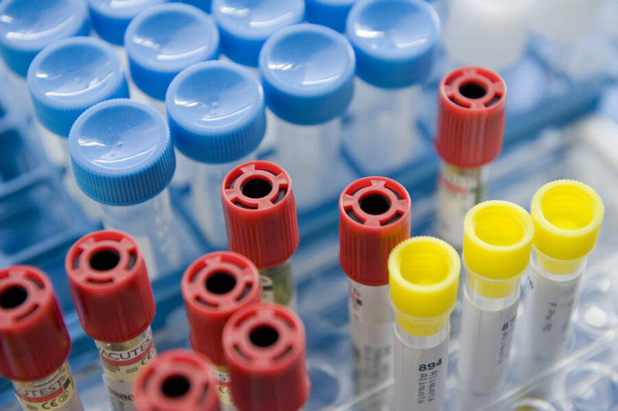 Blood-Laboratory-testing-packages - Check-ups-thiene-schio-vicenza