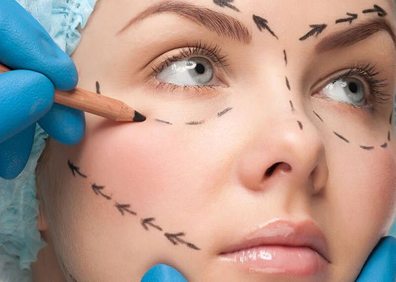 Chirurgia Plastica - thiene vicenza