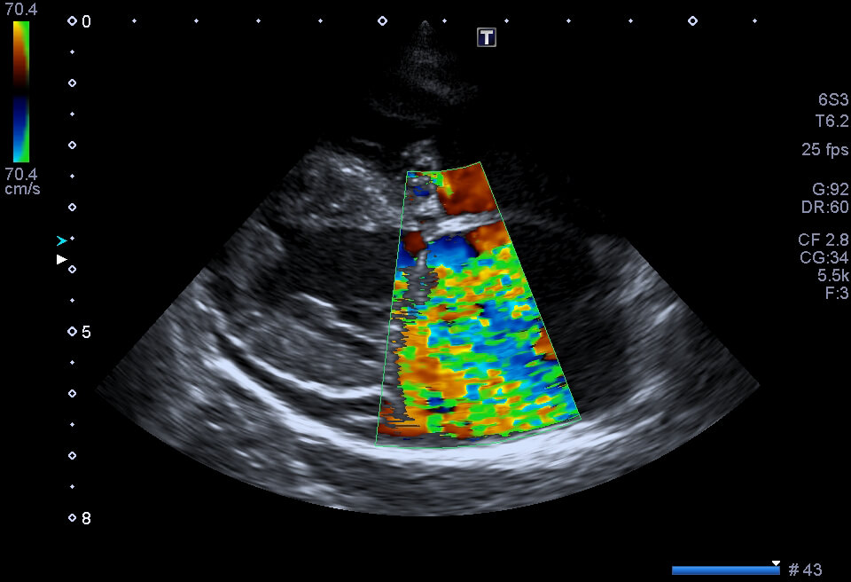 Ecocardiografia - thiene vicenza