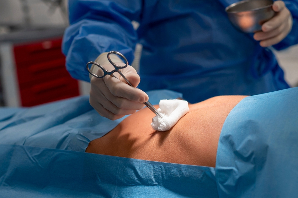 Ernia trascurata rischi