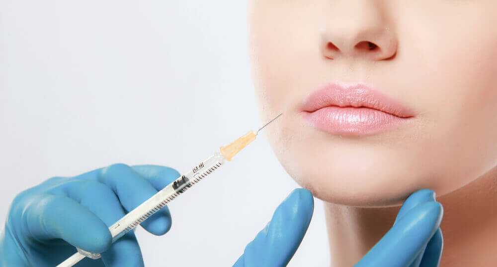 Filler di acido ialuronico per le “rughe del sorriso” Filler di acido ialuronico per le “rughe del sorriso”