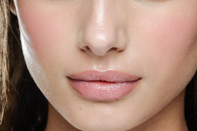 Filler per il trattamento delle cosiddette rughe “codice a barre” Filler per il trattamento delle cosiddette rughe “codice a barre”