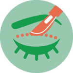 Xantelasmi Palpebrali Xantelasmi Palpebrali