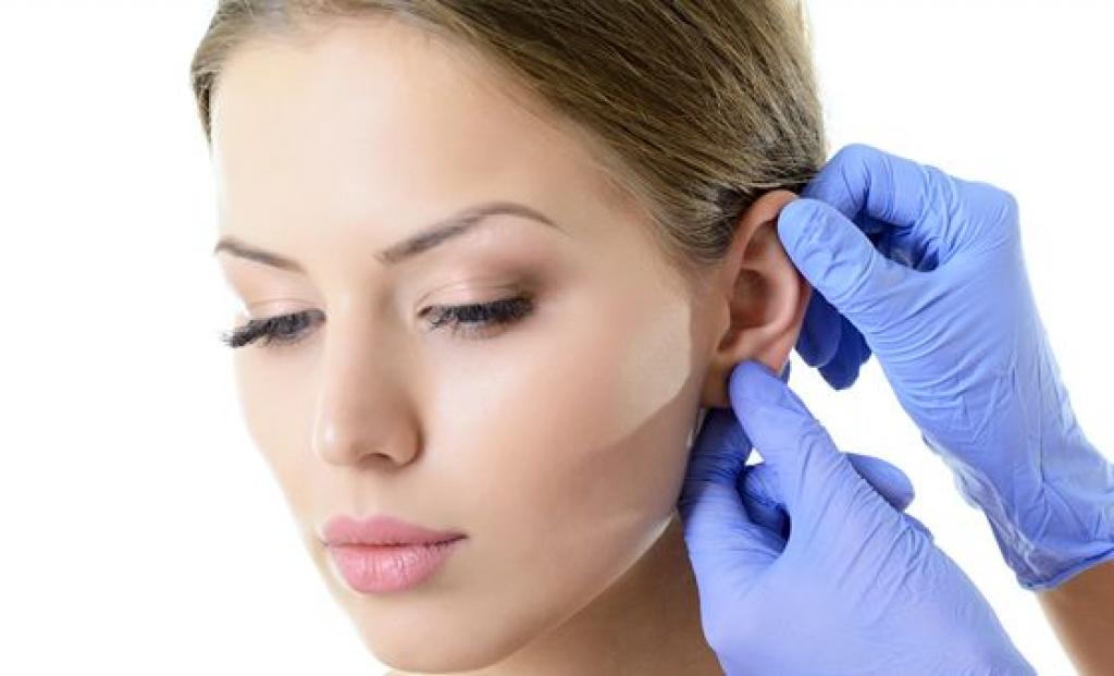 “Orecchie a sventola”: correggerle con l’intervento di Otoplastica