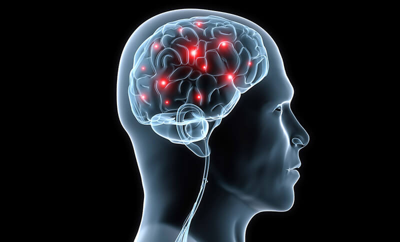 Neurologia thiene vicenza