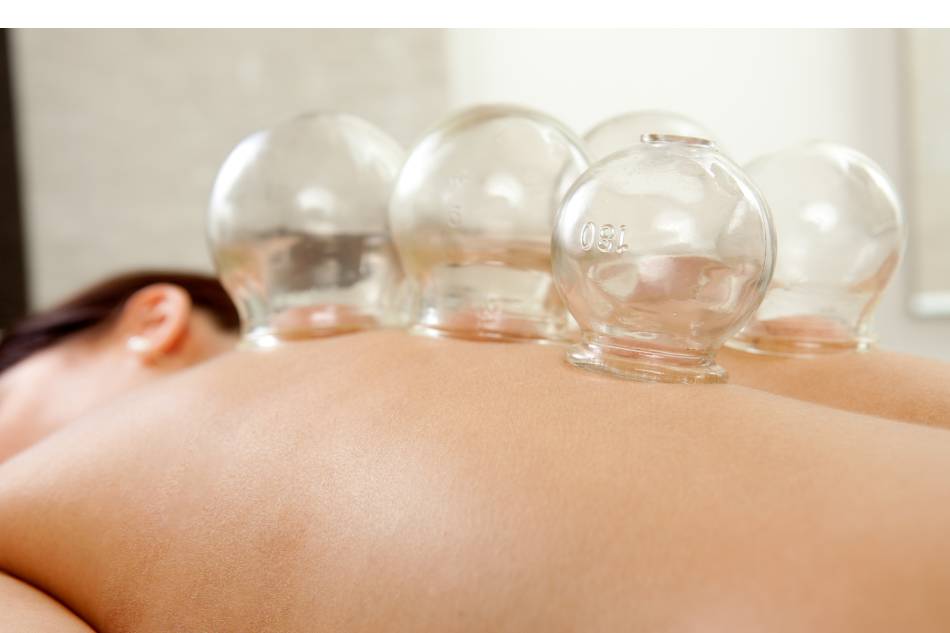 coppettazione thiene schio vicenza