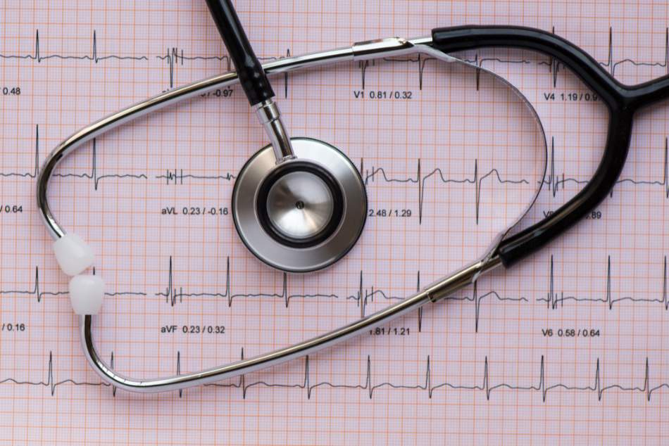ECG elettrocardiogramma thiene schio vicenza