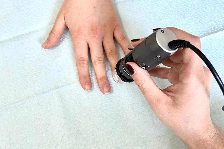 capillaroscopia thiene schio vicenza