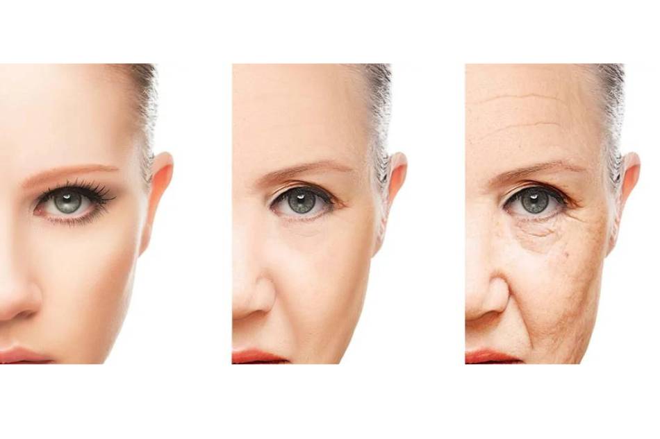 lassità pelle collo e viso medicina estetica thiene vicenza