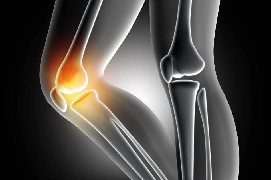 radiografia ginocchio thiene vicenza