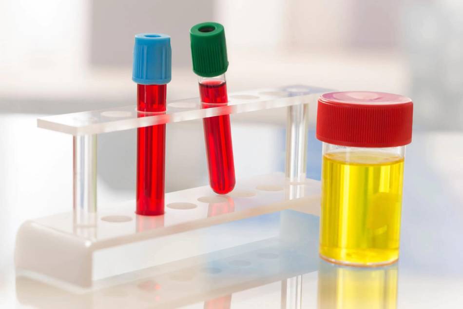 Analisi del sangue e delle urine Analisi del sangue e delle urine