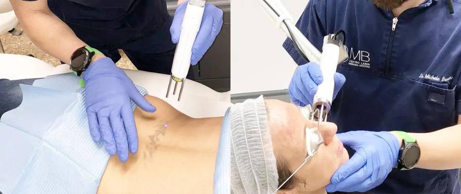 medicina estetica picolaser thiene vicenza