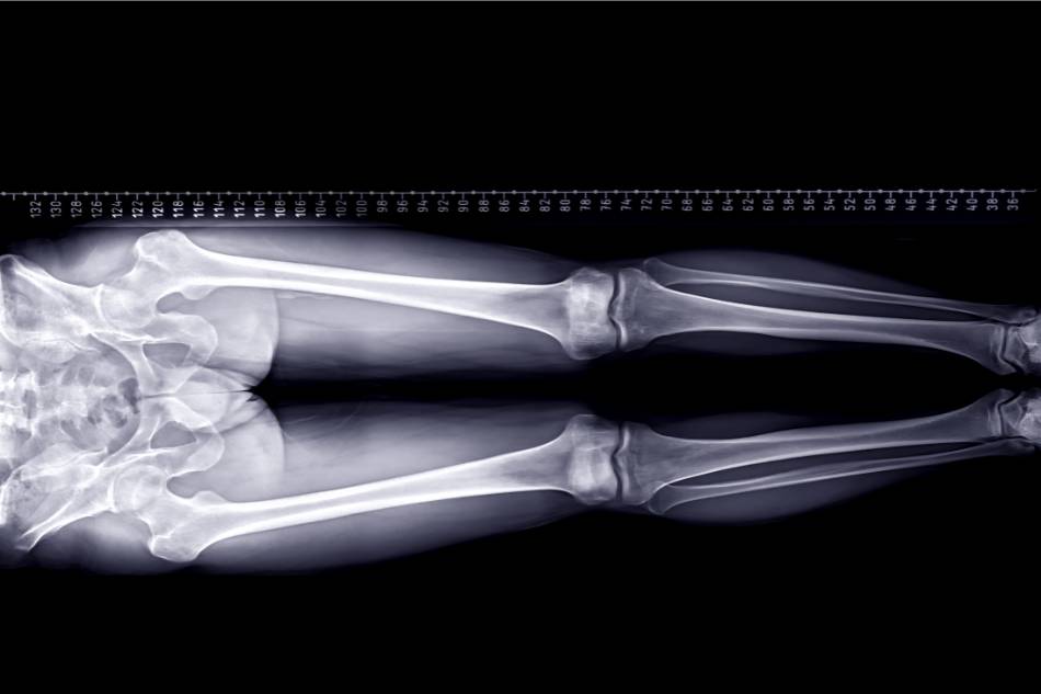 arti-inferiori-in-toto