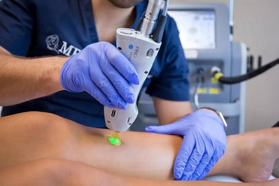 trattamento Depilazione definitiva