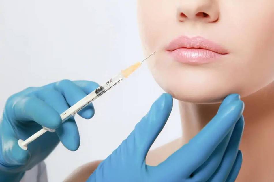 Filler acido ialuronico thiene vicenza