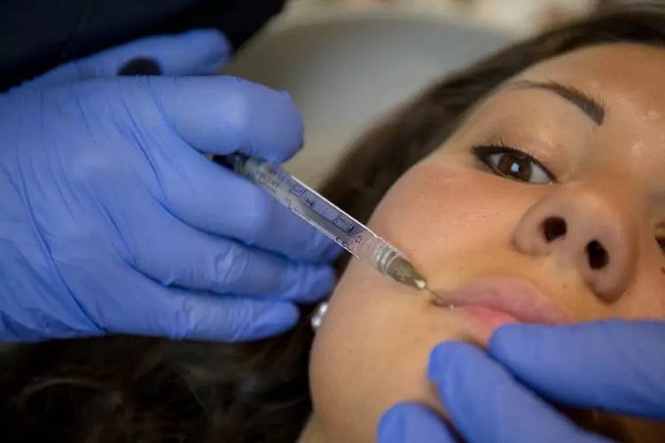 trattamento filler acido ialuronico