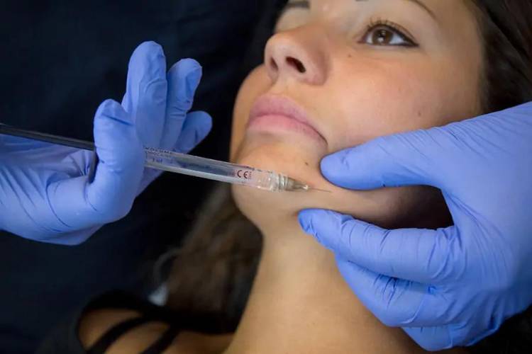 trattamento medicina estetica filler