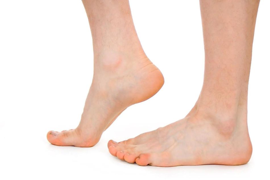 Asportazione dello Sperone - Poliambulatori San Gaetano