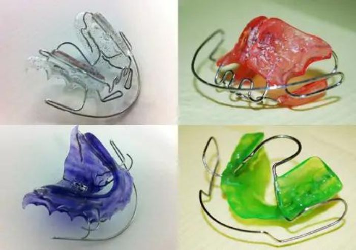 apparecchio denti thiene