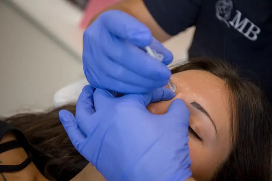 trattemnto Tossina botulinica Thiene Vicenza