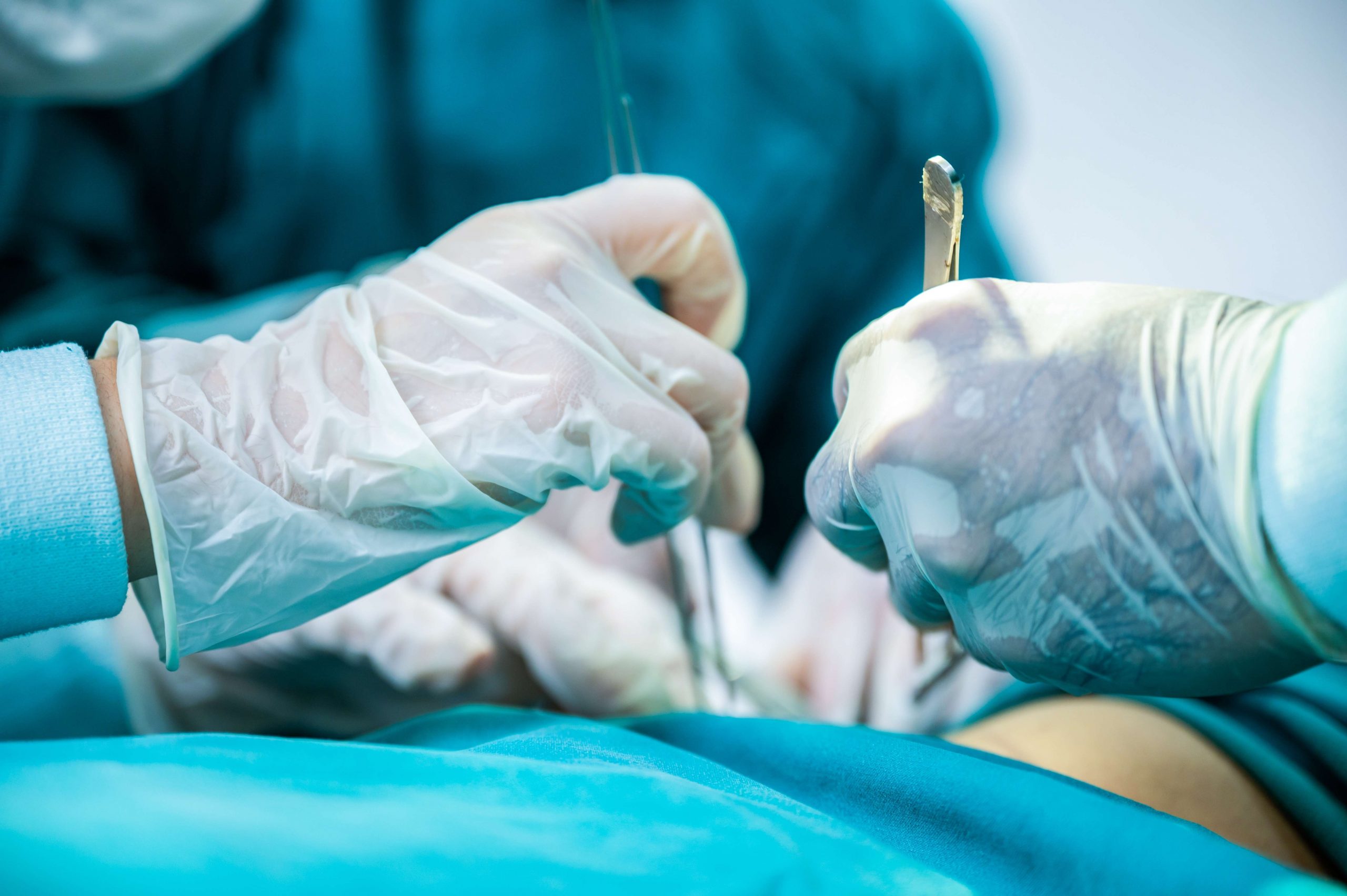 intervento ai testicoli thiene schio vicenza