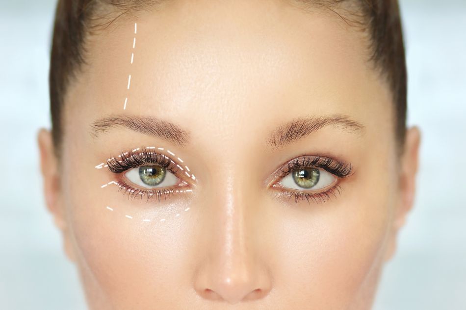 chirurgia-palpebra thiene schio vicenza