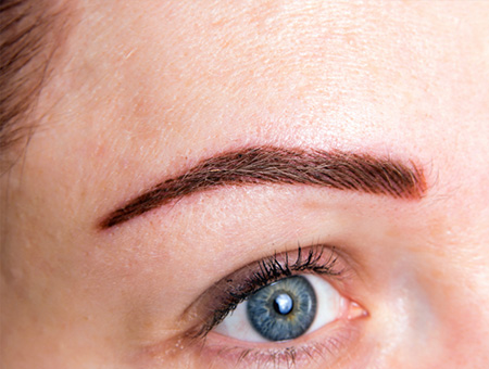 Rimozione tatuaggi cosmetici