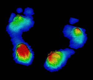 esame baropodometrico