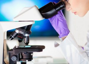 Biopsia: che cos’è e quando si esegue