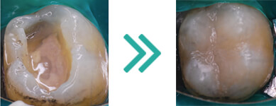 Odontoiatria Conservativa