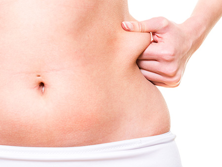 In forma per l’estate: la Criolipolisi un valido strumento per ridurre il grasso localizzato In forma per l’estate: la Criolipolisi un valido strumento per ridurre il grasso localizzato