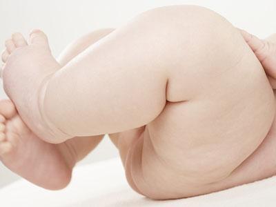 ecografia neonati - thiene vicenza