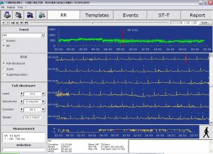 holter cardiaco come funziona