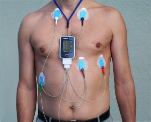 Perché eseguire un Holter Cardiaco?