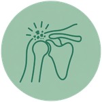 Litoclasia Spalla Litoclasia Spalla