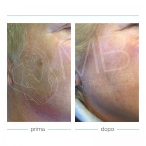 problemi pelle esposizione sole problemi pelle esposizione sole