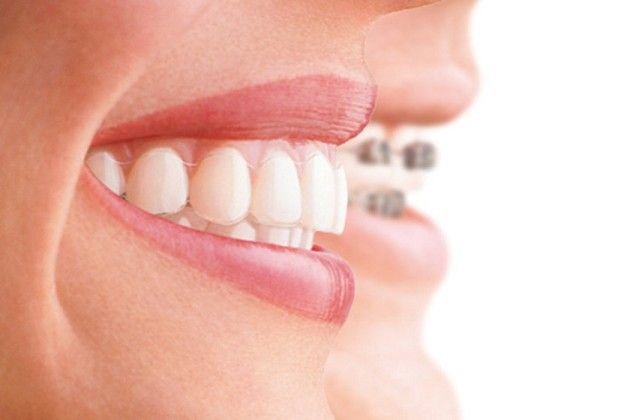 Occlusione dentale, dolori cervicali e postura