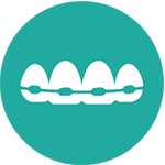 Ortodonzia Invisibile