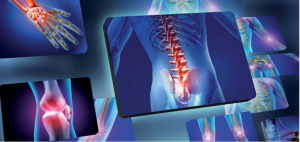 Le Radiografie a Thiene si fanno digitali