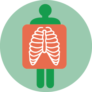 Radiografia Torace Radiografia Torace