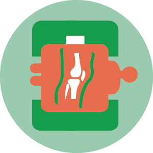 Risonanza Magnetica Ginocchio Risonanza Magnetica Ginocchio