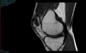 risonanza magnetica aperta