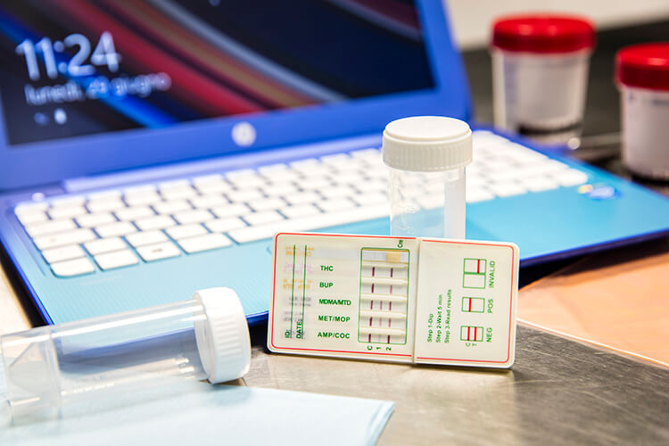 screening droghe thiene schio vicenza