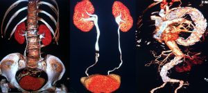 tac-poliambulatorio-san-gaetano