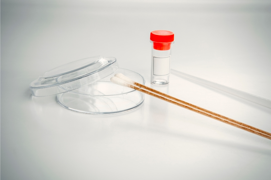 tampone anale per ricerca hpv