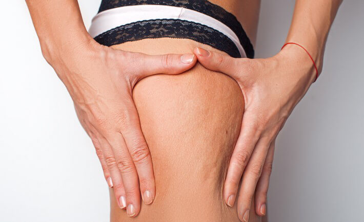 trattamento corpo Mesoterapia