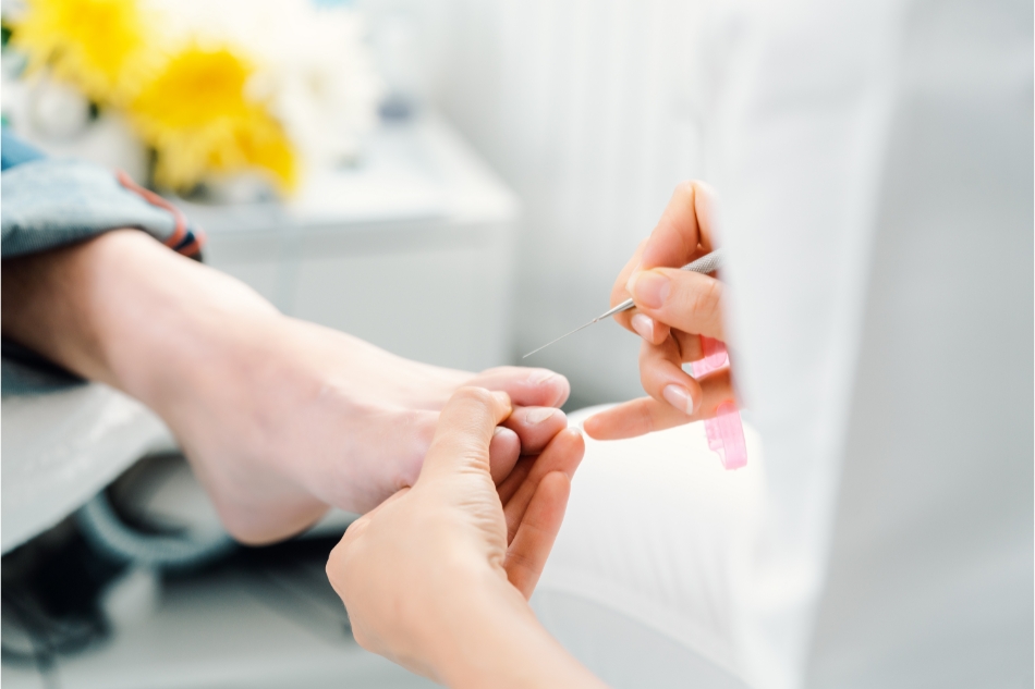 trattamento podologico thiene schio vicenza