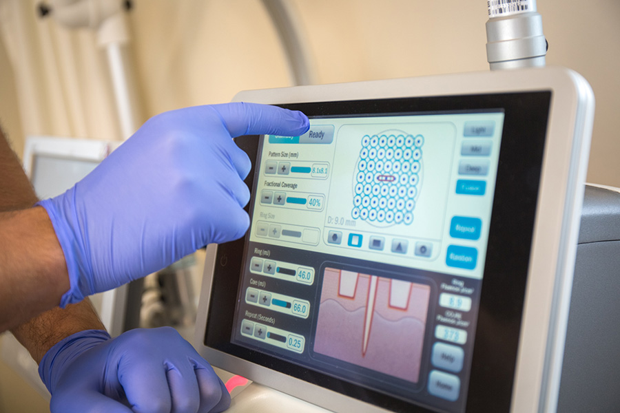 trattamento laser co2re estetica buratto